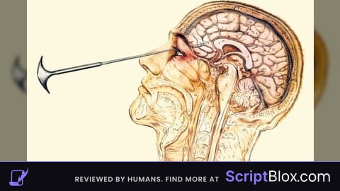 Universal Lobotomy Script