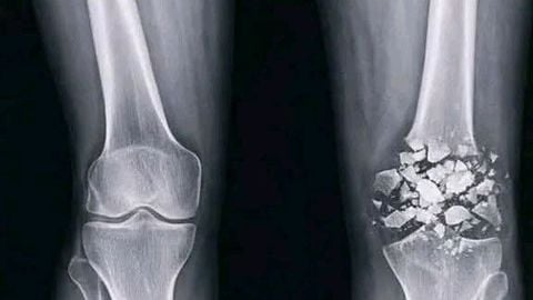 NwtdxAPwcstGlGF - Universal script preview